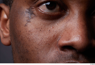 HD Face Skin Demarien Smith cheek eye face nose scar…